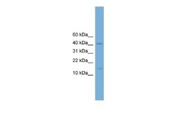 PBX4 Antibody, Novus Biologicals 100 μL; Unconjugated:Antibodies, Polyclonal
